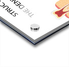 Structure of the dental implant Acrylic print