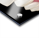 Veneer placement procedure 3D illustration Acrylic print