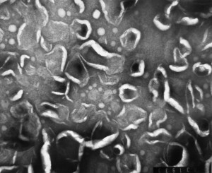 Lipid nanoparticles magnified 32000 times by electron microscope
