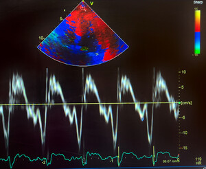 ECHO map and waveforms