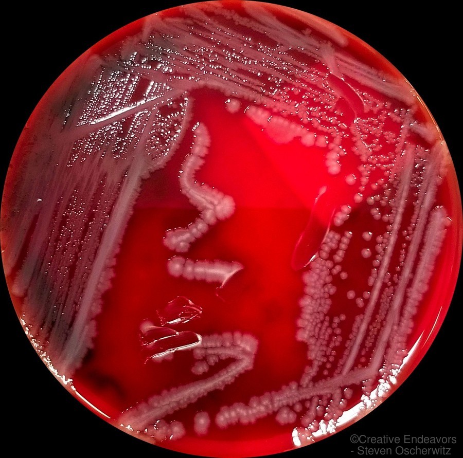 Salmonella Bacteria Growing on Blood Agar by Creative Endeavors ...