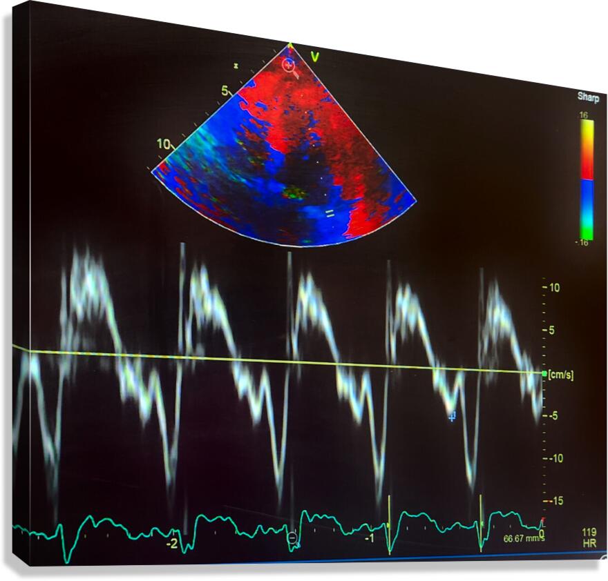 ECHO map and waveforms Canvas Print