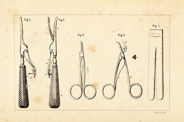 Circumcision instruments Print