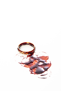 bloodied gold wedding ring