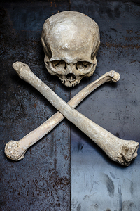 skull and thighbones on a metal