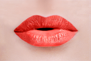 Kiss