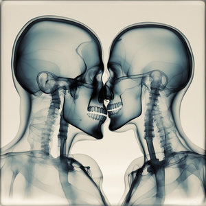 artistic representation of an X-ray image showing a couple kissing