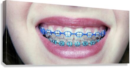 Braces Canvas Print