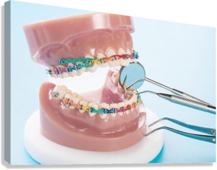 Orthodontics Canvas Print