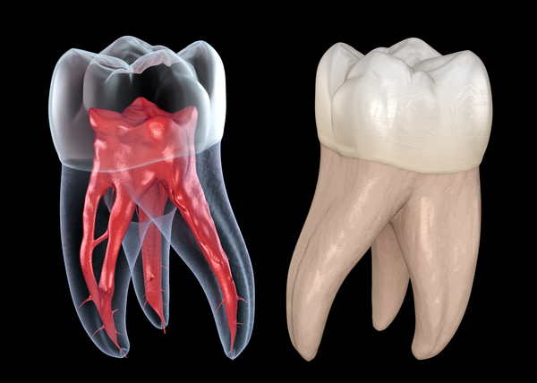 Dental root anatomy - First maxillary molar tooth  Print