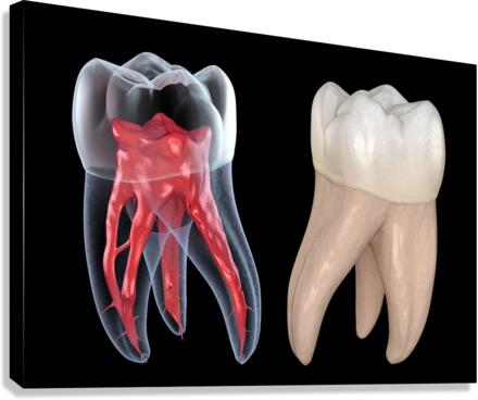 Dental root anatomy - First maxillary molar tooth  Canvas Print