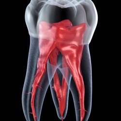 Dental root anatomy - First maxillary molar tooth