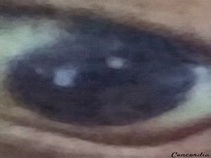 The Eye 1