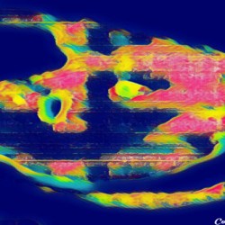 The Eye 9
