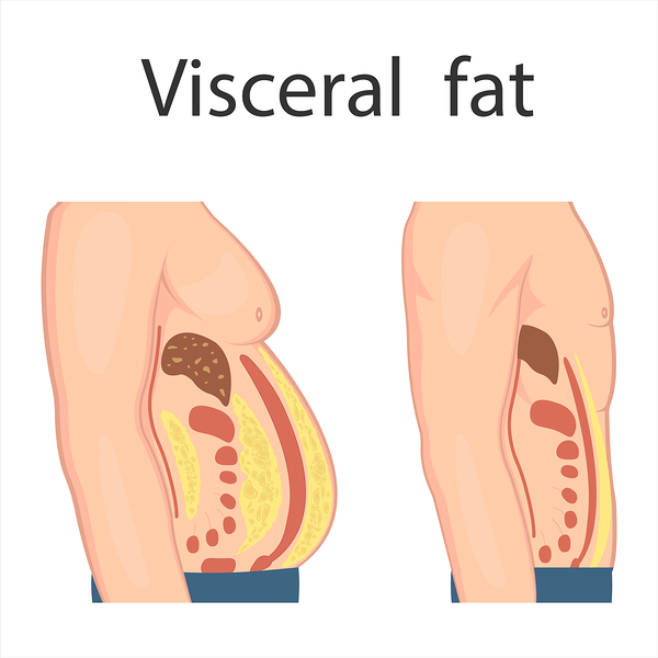 Visceral fat Print