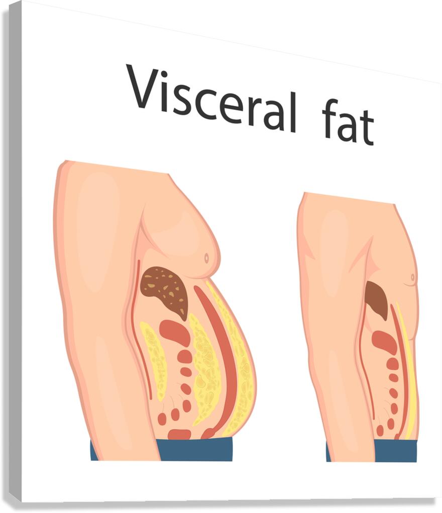Visceral fat Canvas Print