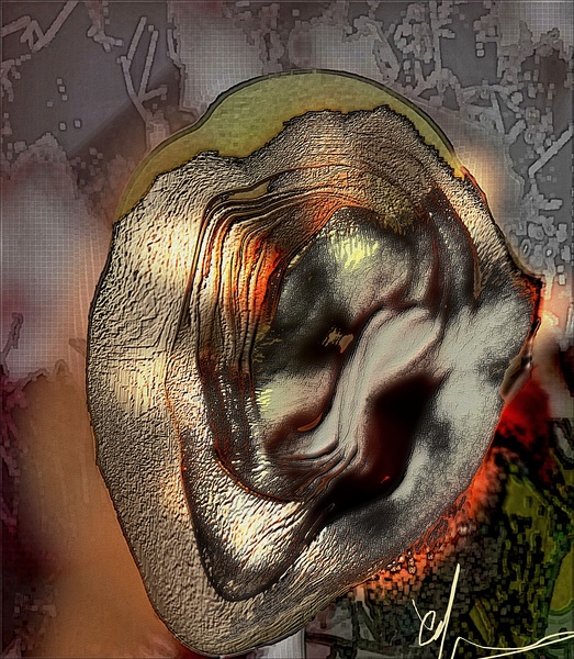 Cauliflower Ear Print