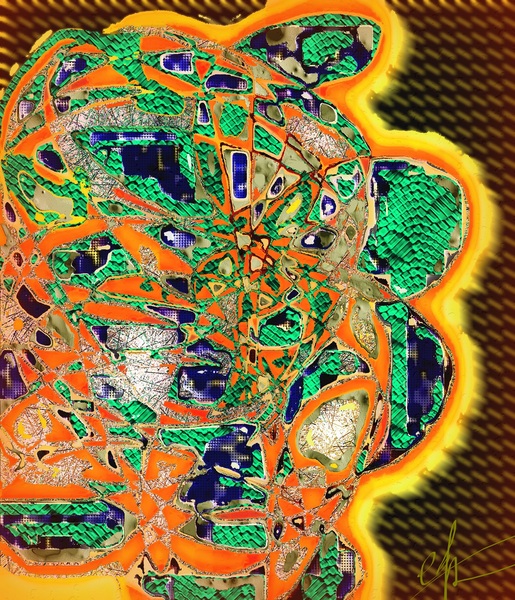 GBM Recurrence Print