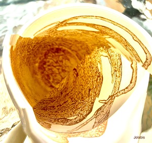fracture 