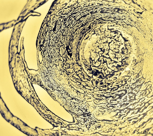  observation  Print