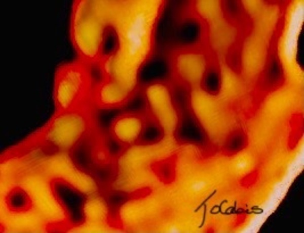 Alveoles  Print