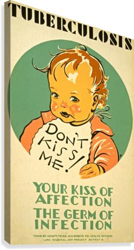 Tuberculosis kiss of affection Canvas Print