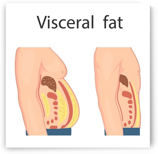 Visceral fat by Point Art
