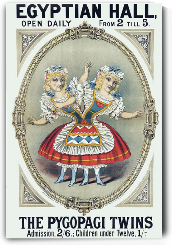 19th Century Advertising Broadside for Pygopagi Conjoined Twins – Historical Exhibition Poster Promoting Medical Curiosities Anatomical Oddities Public Shows Biographical Details and Victorian-Era Popular Entertainment by History In Your Home