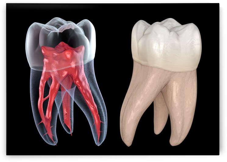 Dental root anatomy - First maxillary molar tooth by Alex Mit