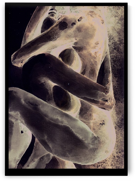 Hug by Dante Orpilla