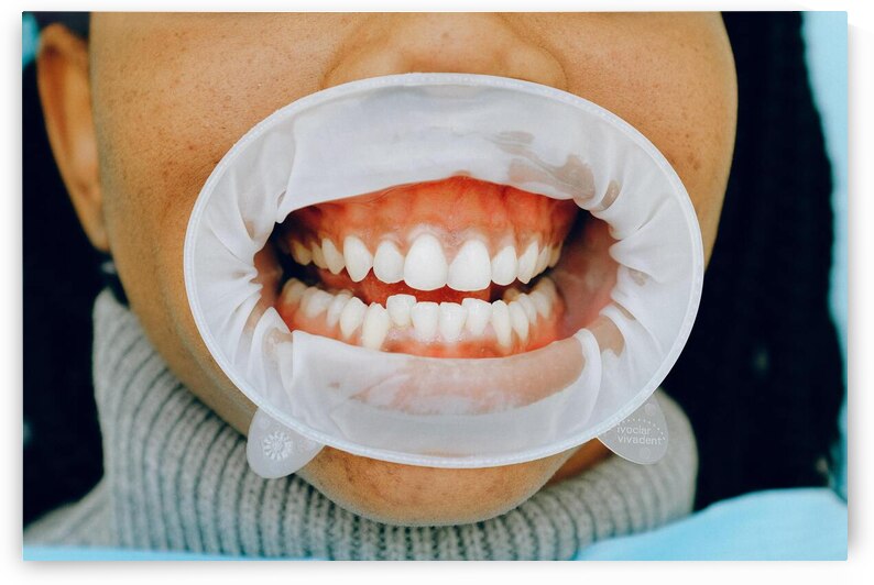 Healthy Gums by Dr Richard Halpern Orthodontist Calgary