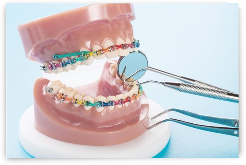 Orthodontics by Dr Richard Halpern Orthodontist Calgary
