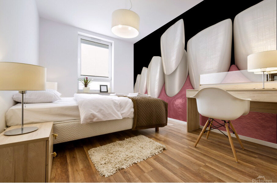 Veneer placement procedure 3D illustration Mural print