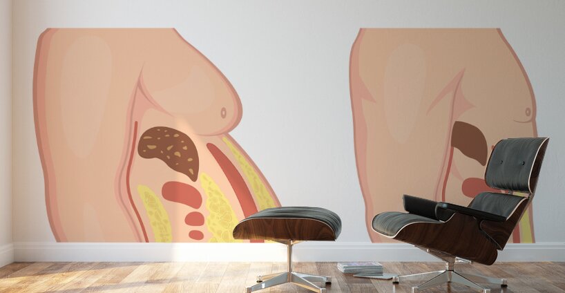 Visceral fat Wall Murals