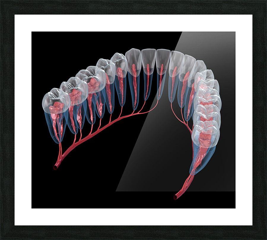 Dental root anatomy Xray view Picture Frame print