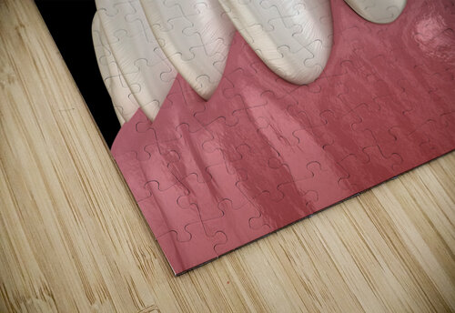 Veneer placement procedure 3D illustration Alex Mit puzzle