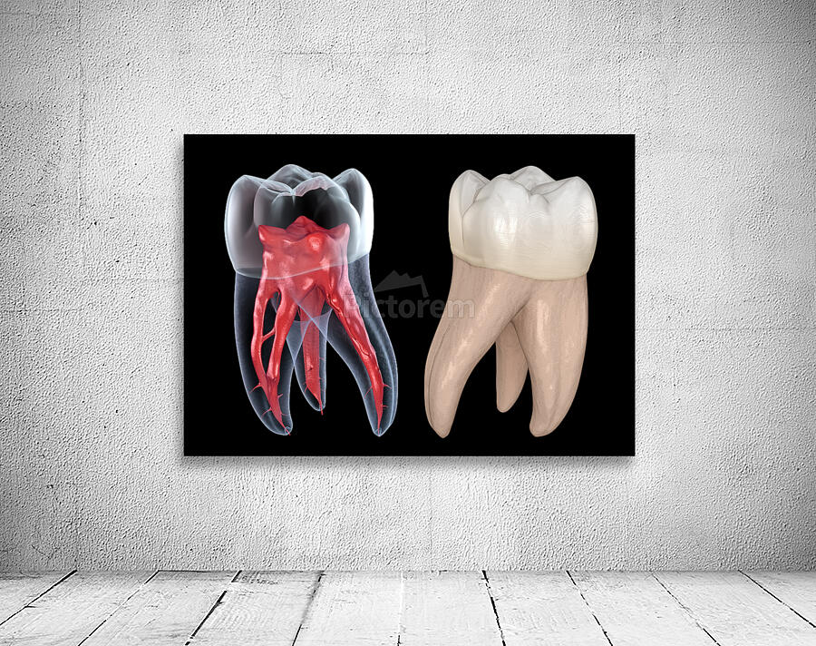 Dental root anatomy - First maxillary molar tooth by Alex Mit