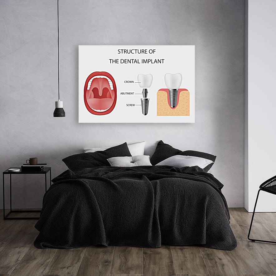 Dental implant structure Reproduction
