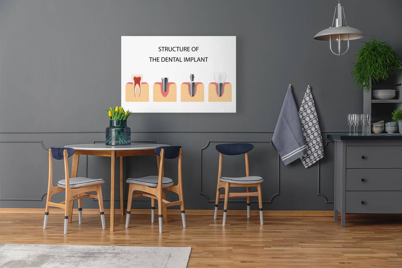 Structure of the dental implant Reproduction