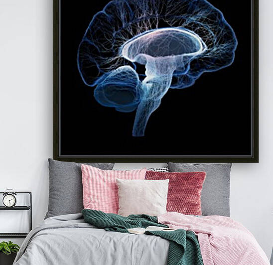 Human brain illustrated with interconnected small nerves by Johan Swanepoel