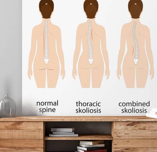 Spinal deformity by Point Art