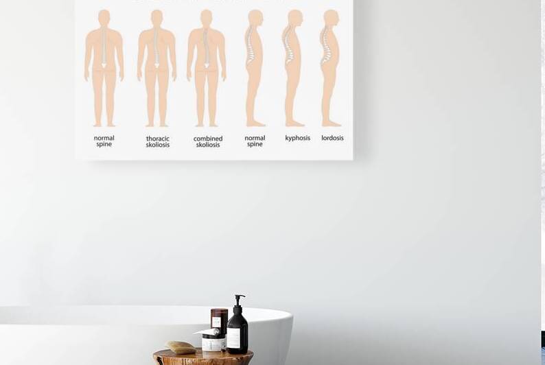 Anatomy of Spine deformity by Towseef Dar