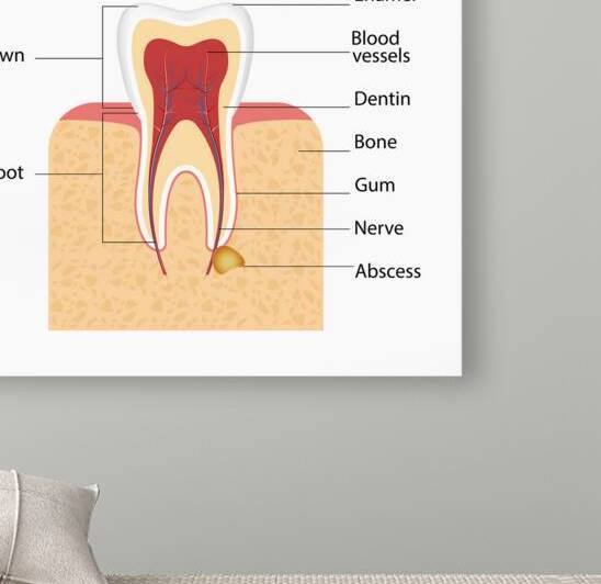 Abscess in the gum by Towseef Dar