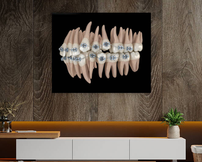 Abnormal teeth position and metal braces tretament by Alex Mit