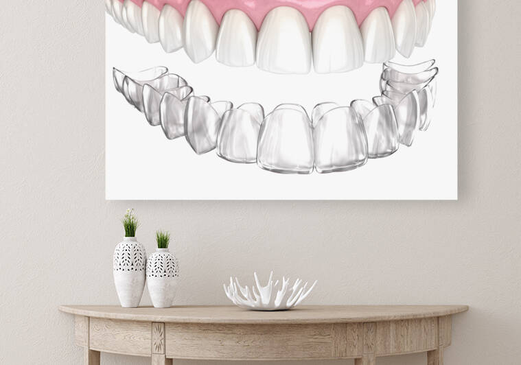 Healthy teeth and invisible retainer by Alex Mit