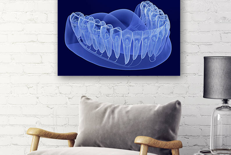 Teeth root anatomy Xray view by Alex Mit