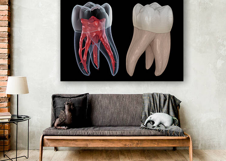 Dental root anatomy - First maxillary molar tooth by Alex Mit
