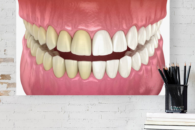 Teeth whitening - before and after. Dental concept by Alex Mit