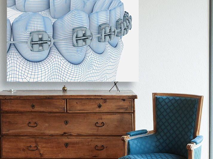 Braces and denture. Wire 3d model illustration by Alex Mit