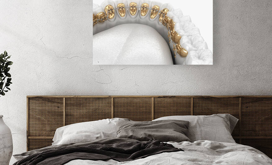 Healthy Teeth with gold braces white style concept dental 3D illustration by Alex Mit